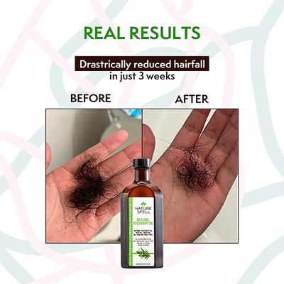 Nature Spell Rosemary With Jamaican Black Castor Oil For Hair & Skin 150 ml - Hair Oils