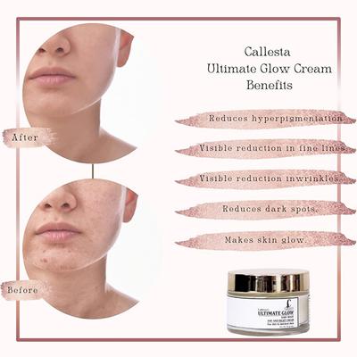 Callesta Ultimate Glow Kojic Magic Face Cream 50 gm - Lotions & Creams