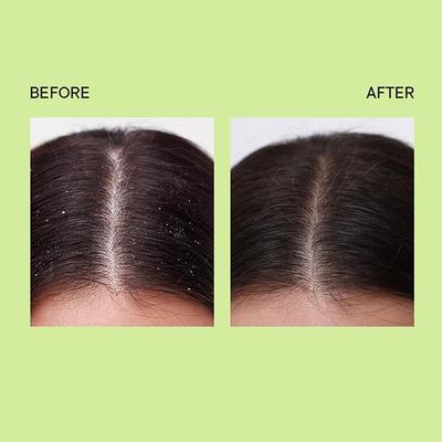 Quench Anti Dandruff Conditioner with Tea Tree Extracts 180 ml - Conditioners