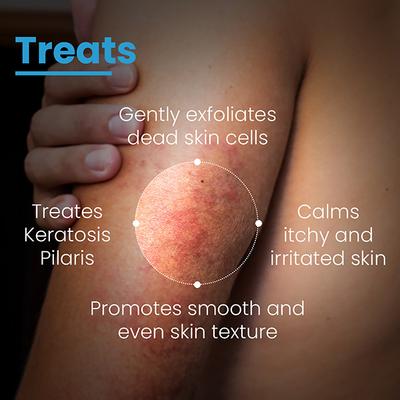 Fixderma Cosmetic Laboratories (FCL) AHA 15 Lotion 100ml - Lotions & Creams