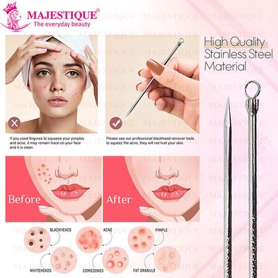 Majestique Blackhead Remover FC56 1's - Others