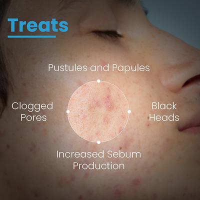 Fixderma Cosmetic Laboratories (FCL) B Prox 10 Face Wash 100 ml - Face Wash & Cleansers