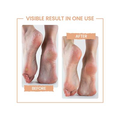 Protouch Bliss Callus Remover 1's - Callus Shavers & Stones