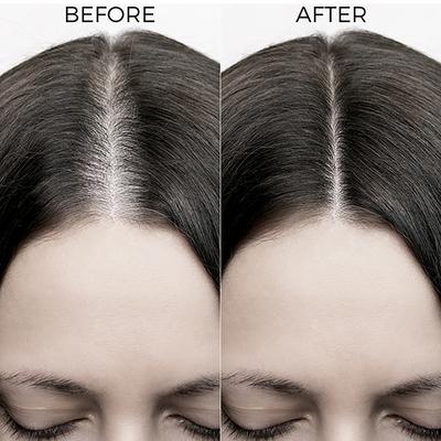 Brillare Onion & Bakuchiol Oil Shots For Hair Fall Reduction 48 Ml - Hair Oils