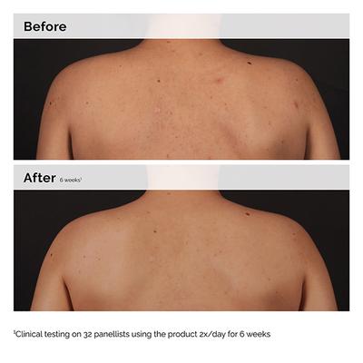 The Ordinary Salicylic Acid 0.5% Body Serum 240 ml - Face Serum