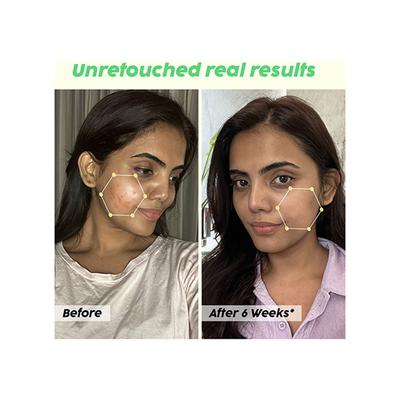 Plix The Plant Fix 2% Salicylic Acid Jamun Active Acne Control Dewy Serum 30 ml - Face Serum