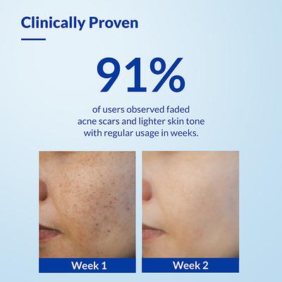 Fixderma Skarfix -TX Face Cleanser with Tranexamic Acid, Kojic Acid & Niacinamide 75 gm - Face Wash & Cleansers