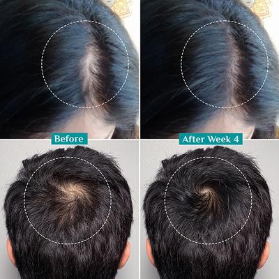 Pilgrim Redensyl & Anagain Advanced Hair Growth Serum 50 ml - Hair Serums