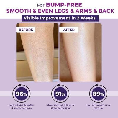 Sanfe Bumps Erasing Body Scrub for Rough Bumpy Skin Tan Strawberry Legs Remove Dirt, Dead Skin 100 gm - Creams, Lotions & Oils