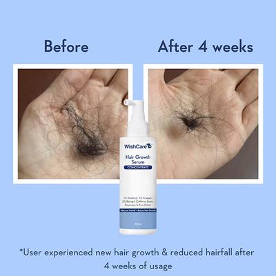 WishCare Hair Growth Serum Concentrate 100 ml - Hair Combs