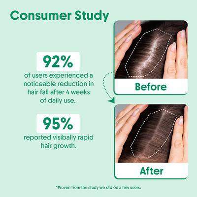 Aravi Organic Rosemary Boosts Hair Growth Serum With Biotin 30 ml - Hair Serums