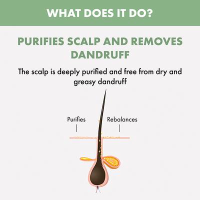 Alfaparf Milano Scalp Rebalance, Exfoliating Scrub, Anti-Dandruff, Hairfall 150 ml - Hair Masks & Packs