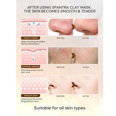 Spantra Detoxifying Clay Mask with Activated Charcoal 125 gm - Masks & Peels
