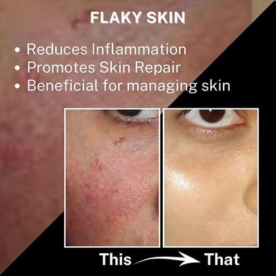 House of Beauty Super Boost Fishy Oil-Dry & Mature Skin For Hydration & Glow with Omega-3 10ml - Face Oils