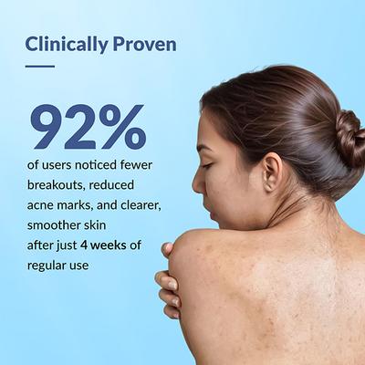 Fixderma Salyzap AZ For Body Acne Spray 100 ml - Face Wash & Cleansers