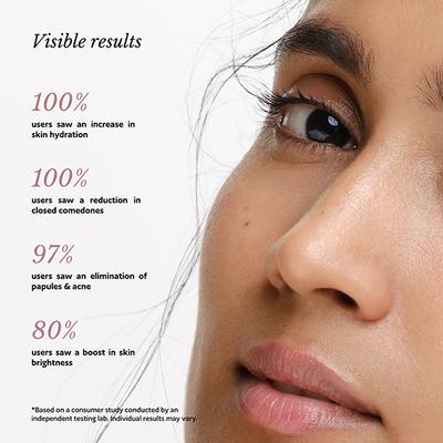 Akind On Cloud Nine Lightweight Moisturizer 50 gm - Face Moisturizers