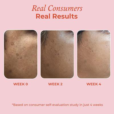 The Pink Foundry - 15% Vitamin C Brightening Serum 30 ml - Face Serum