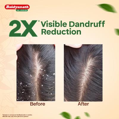 Baidyanath Curry Leaves Hair Oil 200 ml - Speciality Medicines