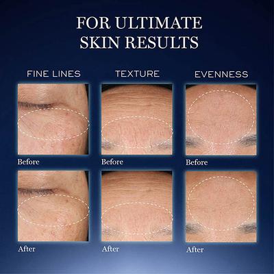 Lancome Genifique Ultimate Skin Repair Serum With Beta Glucan (Suited for Indian Skin) 20 ml - Face Serum