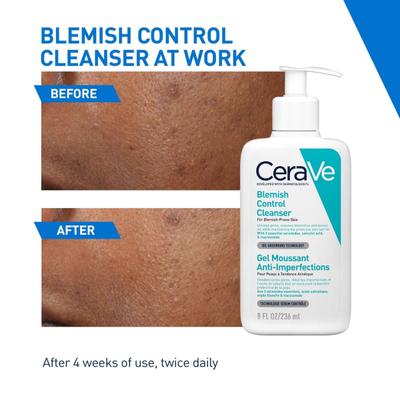 CeraVe Blemish Control Cleanser 236 ml - Face Scrubs