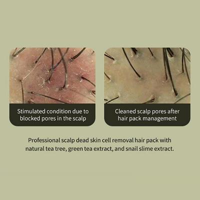 Lador Tea Tree Scalp Clinic Hair Pack 200 ml - Hair Masks & Packs