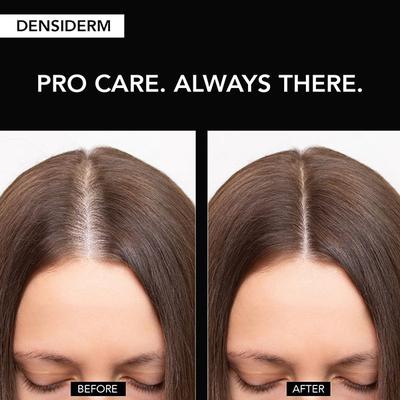 O3+ Women Densiderm Hair Growth Serum Scalp Spray with Ginseng Hair Fall Control & Hair Growth 50 ml - Hair Serums