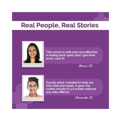 The Derma Co. 2 Percent Alpha Arbutin Face Serum for Dark Spots & Uneven Skin Tone 30ml - Face Serum