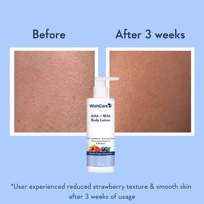 WishCare 10% AHA + 1% BHA Body Lotion - Smooths Rough & Bumpy Skin - With NiacinamiderapeFruit & Blueberry 200 ml - Lotions & Creams