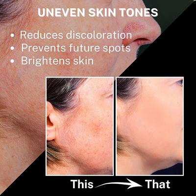 House of Beauty Brown Spot Corrector For Uneven Skin, Melasma, Acne with Salicylic, Niacin 15ml - Bb & Cc Creams