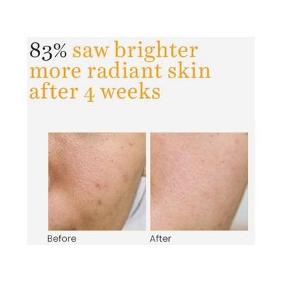 O3+ Professional Vitamin C Glow Serum 30 ml - Face Serum