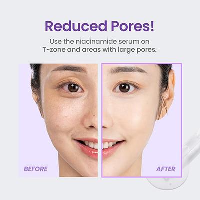 Tirtir Niacinamide 20% Serum 30 ml - Face Serum