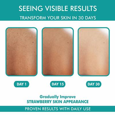 The Love Co. Bacne Warrior Acne Fighting Body Spray - With 02% Salicylic Acid + Niacinamide + Cucumber + Aloevera 100 ml - Creams, Lotions & Oils