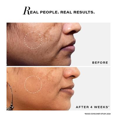 Novology Bi-Phasic Serum for Hyperpigmentation, Dark Spots & Acne Marks - Dry-Combination Skin 28 ml - Face Serum