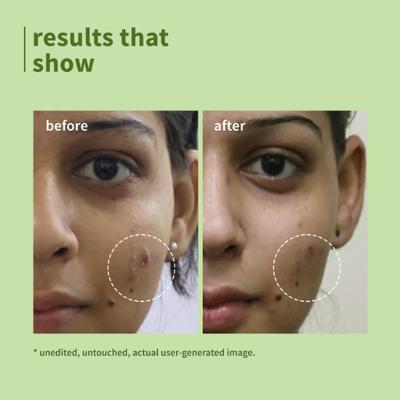 Plum Green Tea Pore Cleansing Face Wash - Acne Face Wash, Oily Skin Face Wash for Women & Men 100 ml - Face Wash & Cleansers