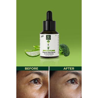Organic Harvest Vitamin A Face Serum with Broccoli & Aloe Vera Ideal for Dry Skin, Anti-Ageing, Reduces Wrinkles 30 ml - Face Serum