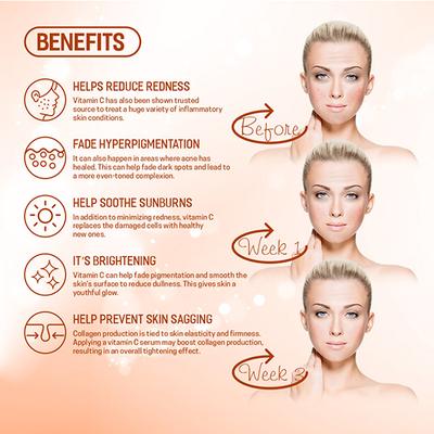 Spantra Vitamin C Facial Serum 50 ml - Face Serum