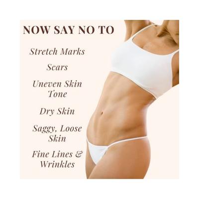 Essentia Extracts Anti-Stretch Marks Oil 100 ml - Stretch Mark Cream