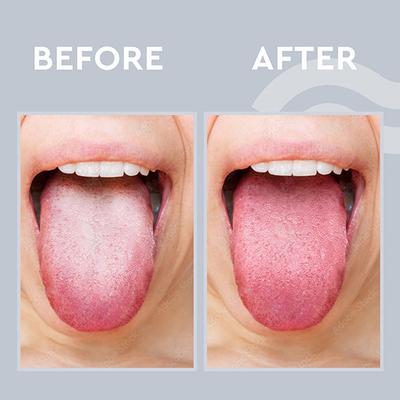 Gubb Tongue Cleaner Loop - Copper 50 gm - Floss & Tongue Cleaners