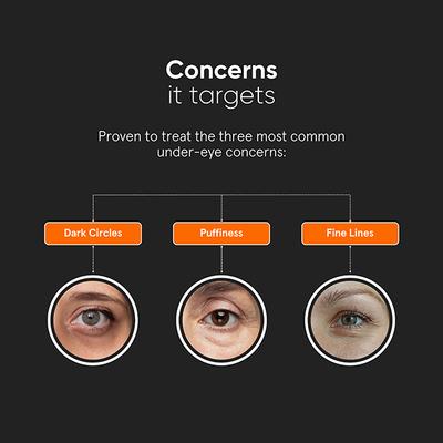 Minimalist Vitamin K + Retinal 01 Percent Eye Cream Dark Circle Puffiness Fine Lines 14 gm - Under Eye Creams & Serums