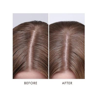 Moroccanoil Dry Scalp Treatment 45 ml - Hair Oils