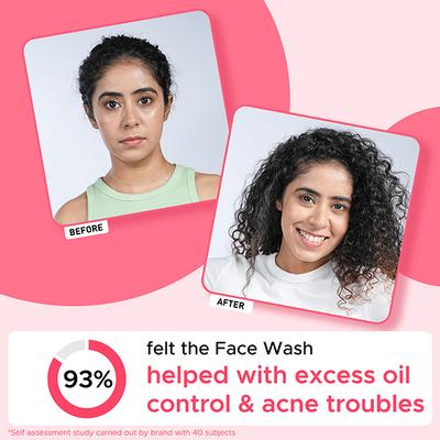 Pure Sense Guava Groove Face Wash Fights Acne and Controls Excess Oil For Men & Women - 100 ml - Face Wash & Cleansers