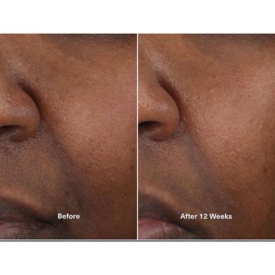 La Mer The Concentrate 50 ml - Face Gels