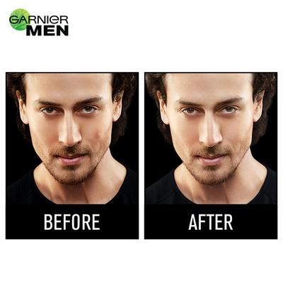 Garnier Men Acnofight Pimple Clearing Brightening Moisturiser 45 gm - Face Creams