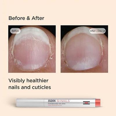ISDIN Si Nails Nail Strengthening Treatment 2.5 ml - Nail Care