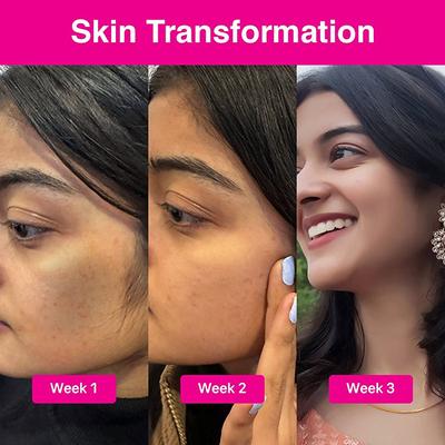 Cos-IQ ABP 22 percent Regular Use Exfoliating Peel AHA 15 percent plus PH 5 percent plus BHA 2 percent 30ml - Scrubs & Exfoliants