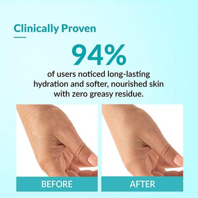 Fixderma Moisturizing Lotion Ideal For All Skin Types 150 ml - Face Gels