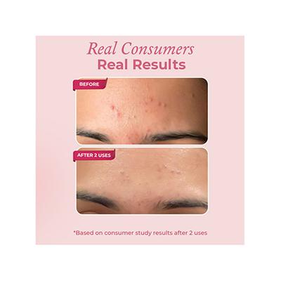 The Pink Foundry Overnight Acne Spot Corrector 30 ml - Skin-Treatment