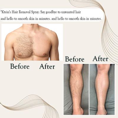 Ktein Fermented 5 Oil and Avocado Men's Hair Removal Spray 100 ml - Hair Sprays & Mists