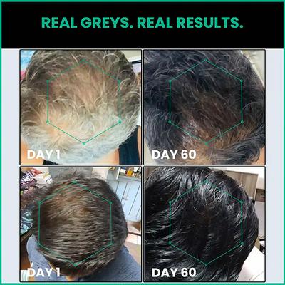 Thriveco Anti-Greying Hair Prime Serum, Reverses Premature Greying 50 ml - Hair Serums