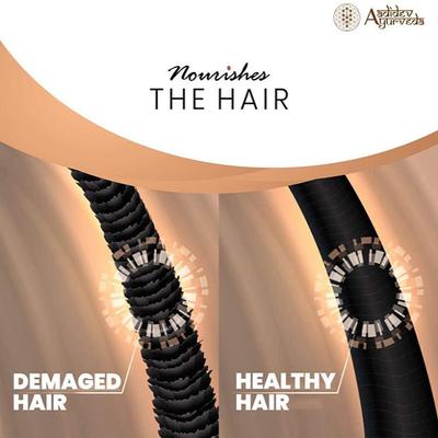 Aravi Organic Hair Growth Hair Oil with Onion Oil 200 ml - Hair Oils